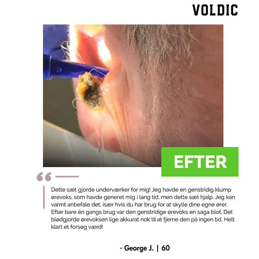Voldic™ Elektrisk Ørevoksfjerningssæt